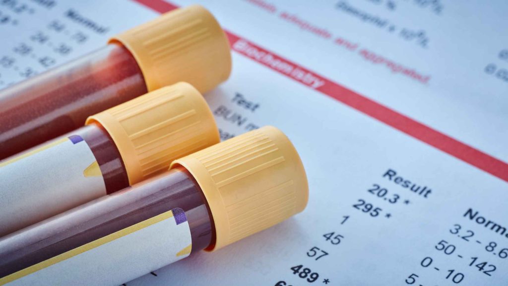 Close-up of blood sample vials on lab report, representing medical testing for diagnosing alcoholic gastritis.