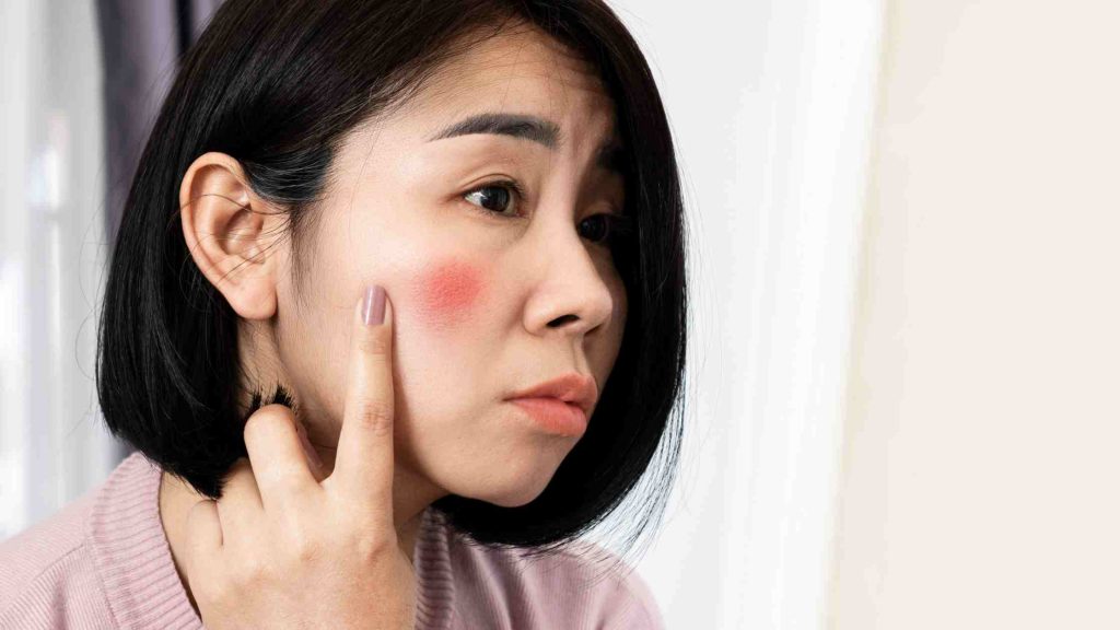 Woman touching cheek with visible red blush, assessing if it’s normal redness or a potential skin irritation.