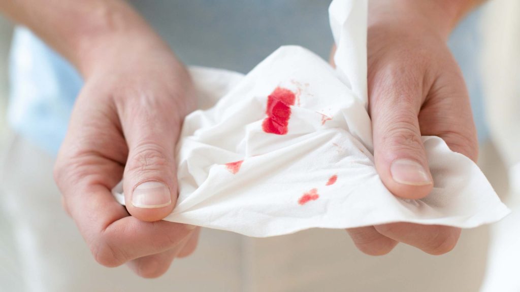 Close-up of hands holding tissue with blood stains, representing vomiting blood after alcohol consumption.